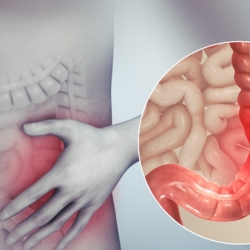 Viêm Đại Tràng Có Nguy Hiểm Không?