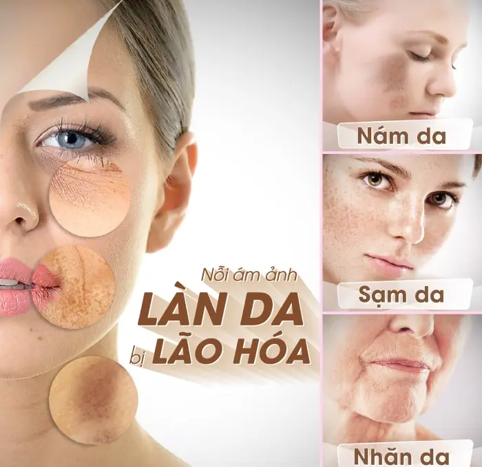 sạm da, nám da, khô da ở phụ nữ