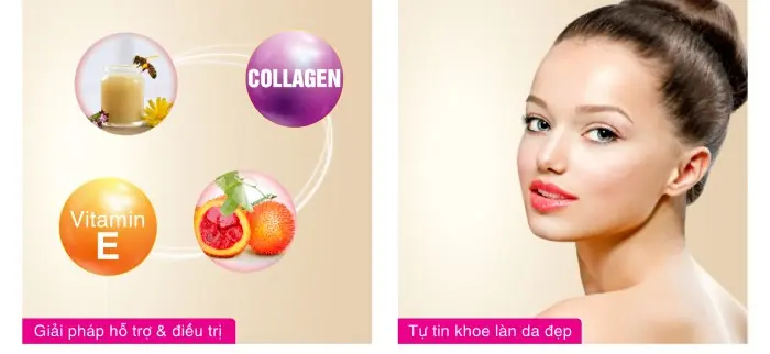 viên uống đẹp da lycopen