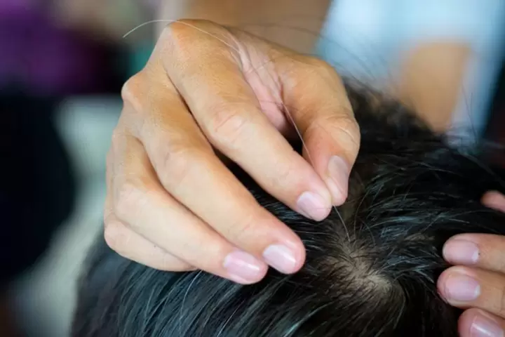 T&aacute;c hại của việc nhổ t&oacute;c bạc